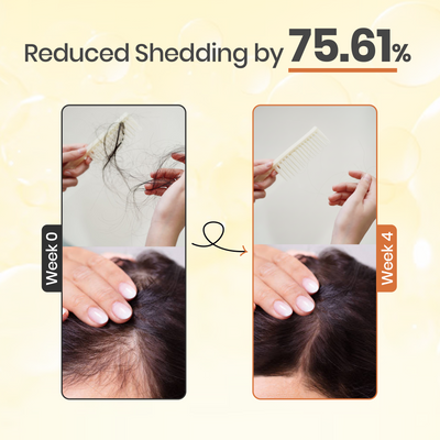 Korean Hair Growth Serum by Yuki